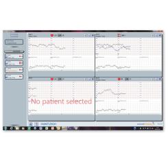 Fetal Care 3 (FC3) Software für CTG-Analyse am PC 